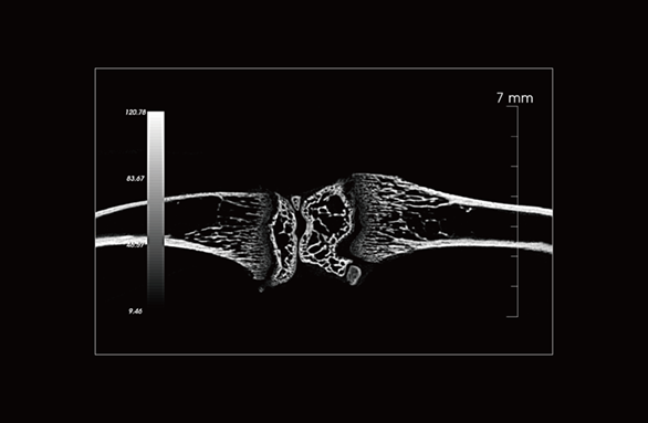 Mouse bone trabecula
