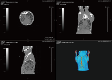 Diffusion of lung tumor in mouse
