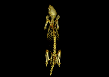 Whole body bone scan