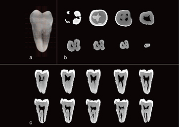 Continuous section of teeth