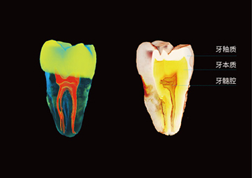Segmentation of Dental Enamel, dentin, Pulp cavity