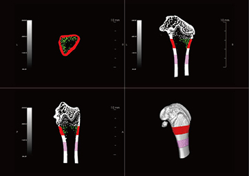 Selection of region of interest in rat femurs