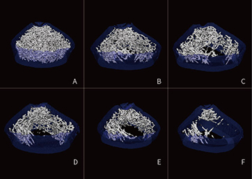 Difference of bone trabeculae between normal group and drug intervention