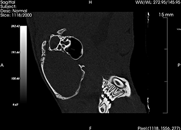 Mouse dental pulp