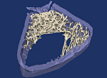 Osteoporosis rat bone