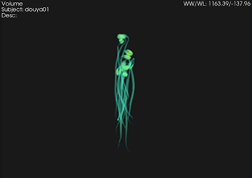 bean sprout